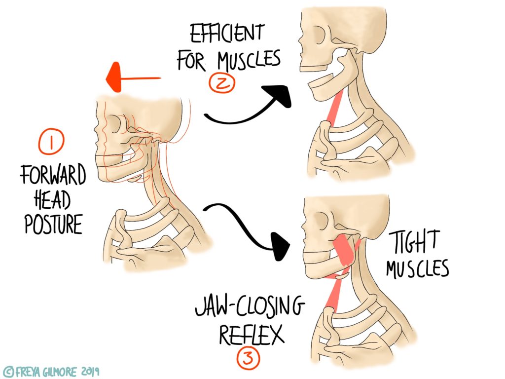 Why do my shoulders always feel so tight and knotty? — Stockbridge  Osteopathic Practice