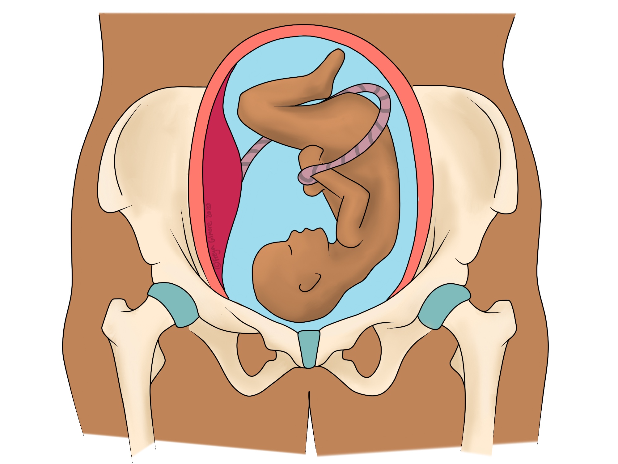 SPD: The pubic symphysis in pregnancy