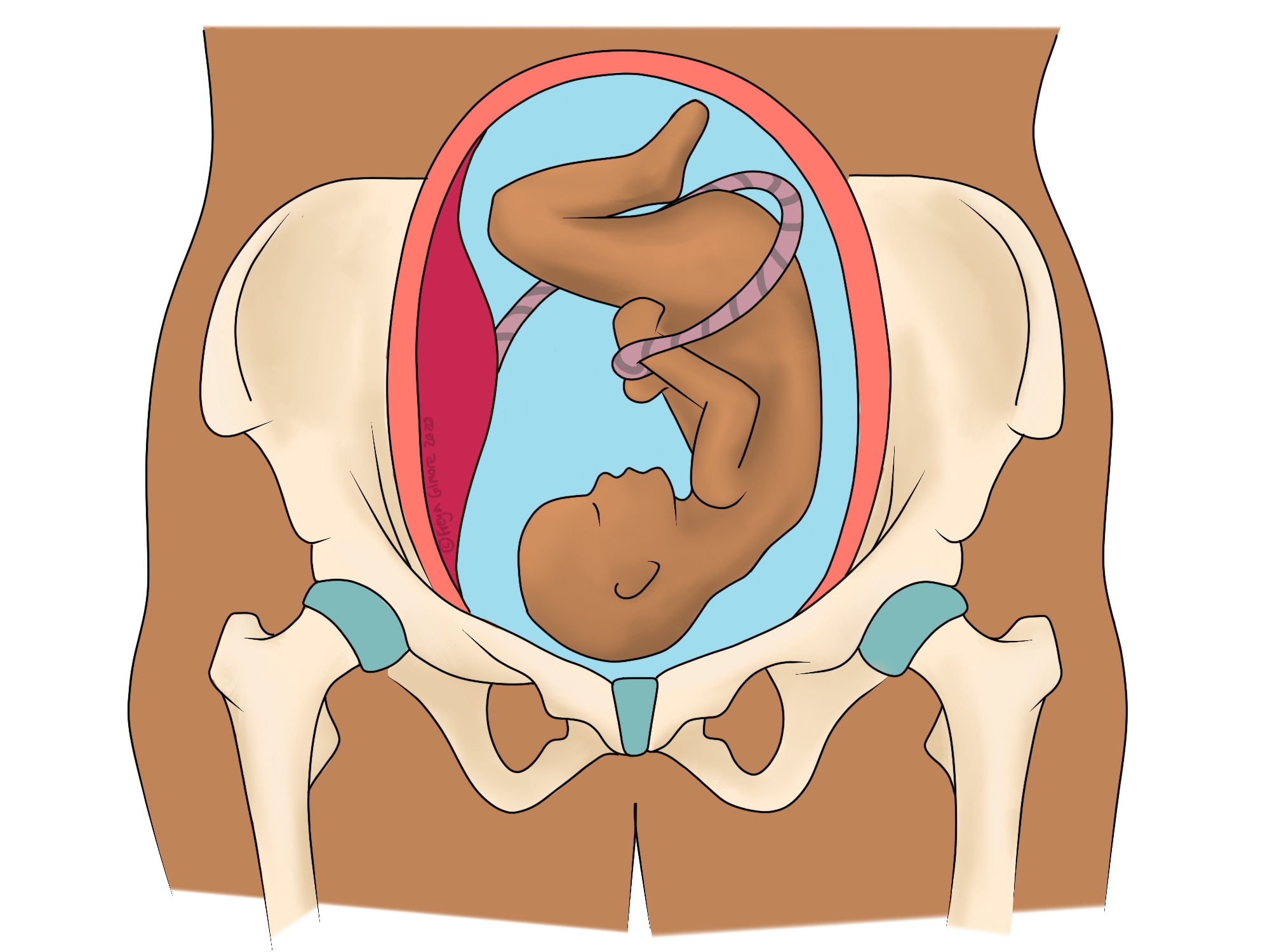 SPD And PGP Pelvis Pain In Pregnancy Beth Forrest Osteopathy