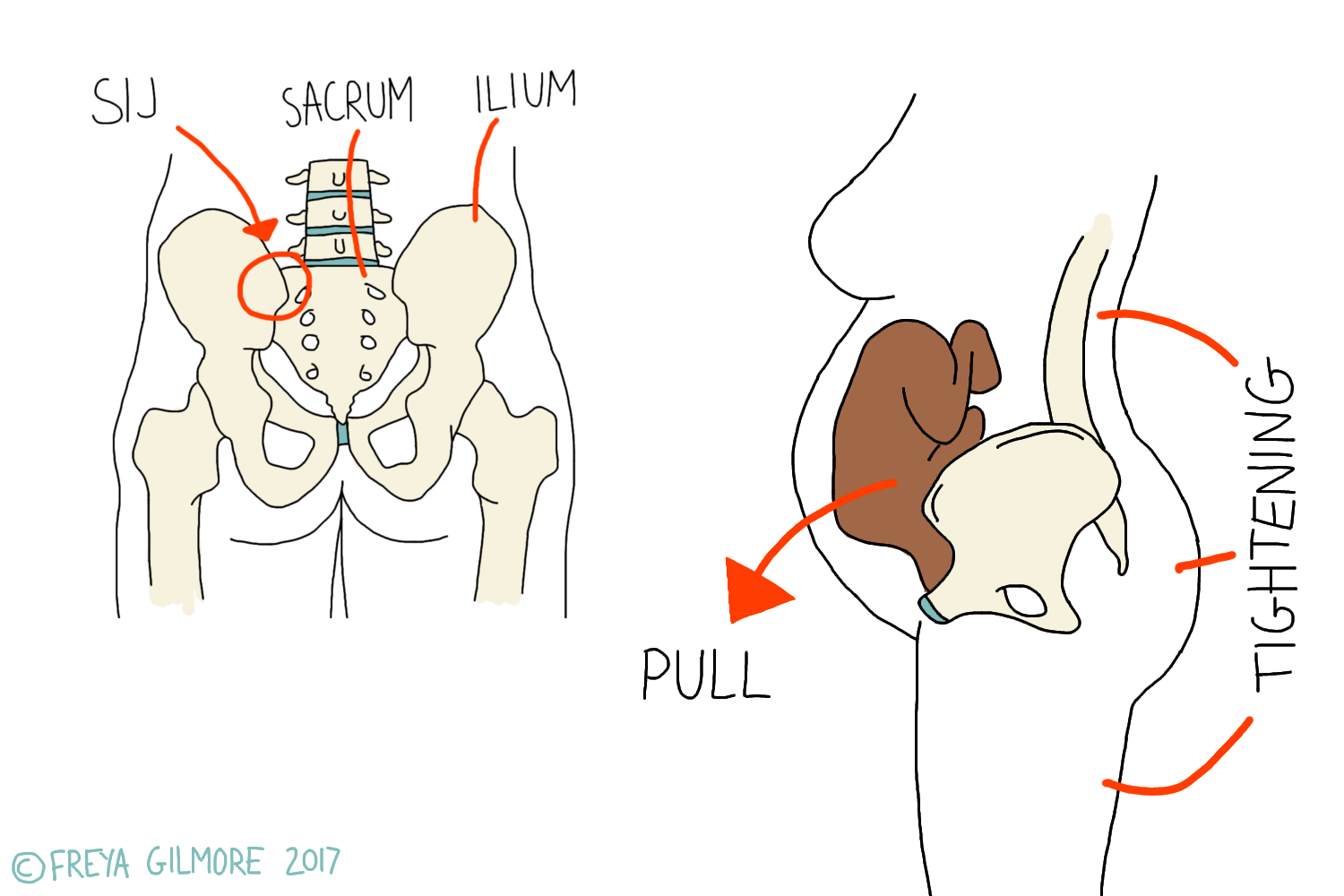 Understanding Pelvic Girdle Pain (PGP) During Pregnancy - Malvern Physio  Clinic