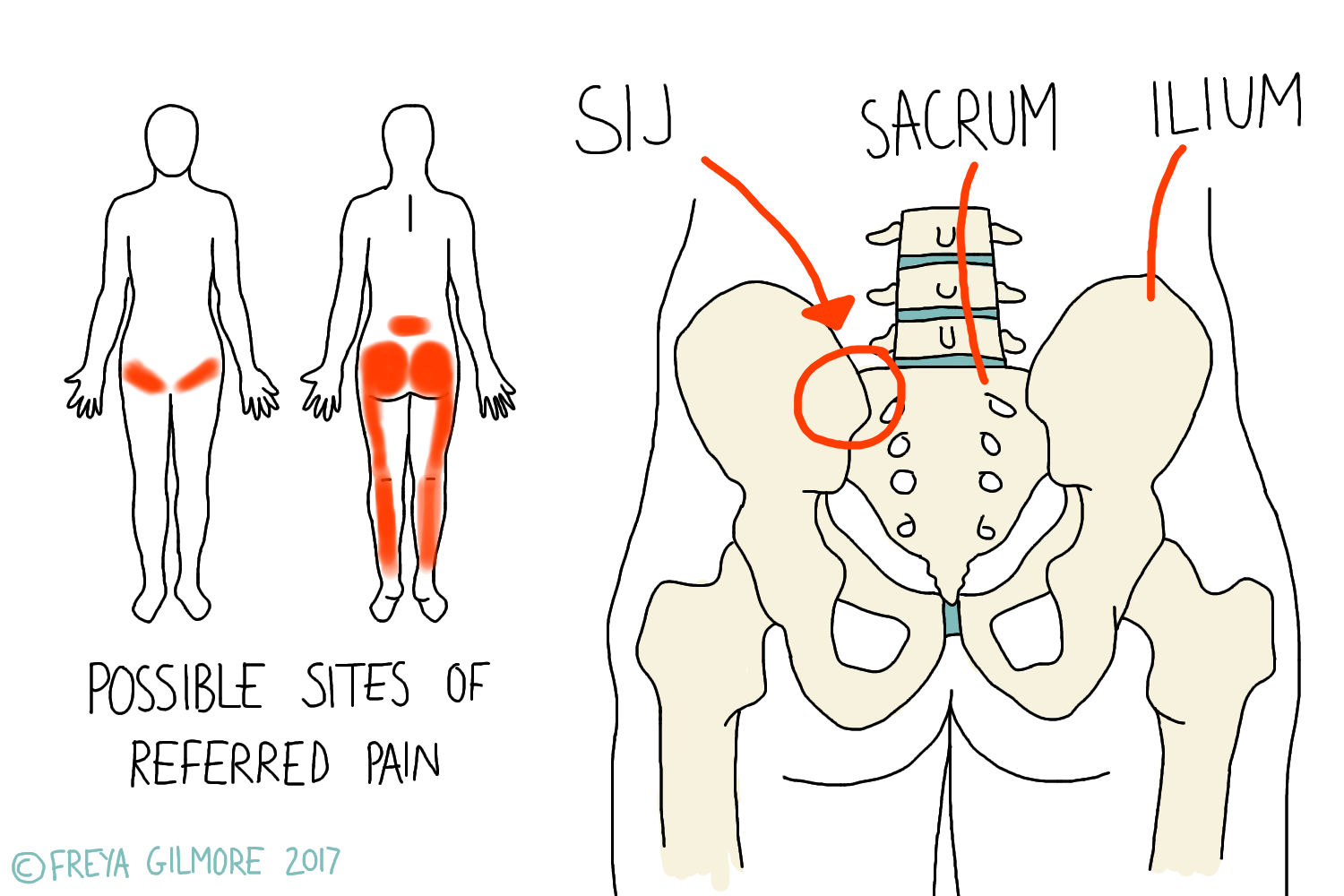 Read more about the article The Sacroiliac Joint (SIJ)