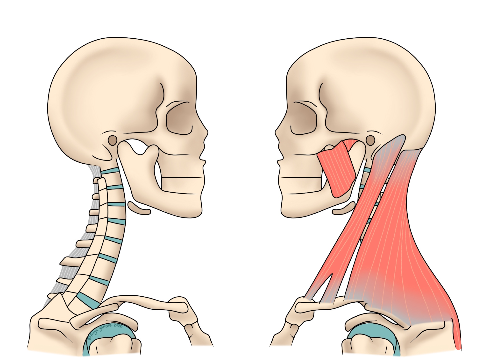 Neck pain