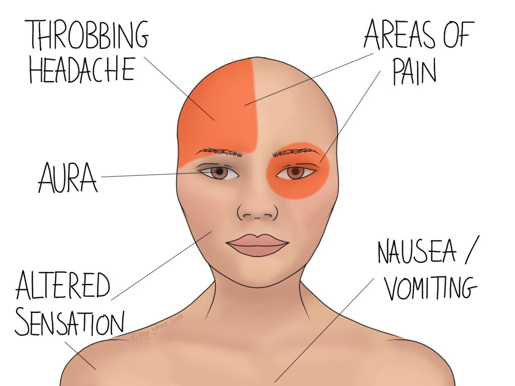 Symptoms of Migraine