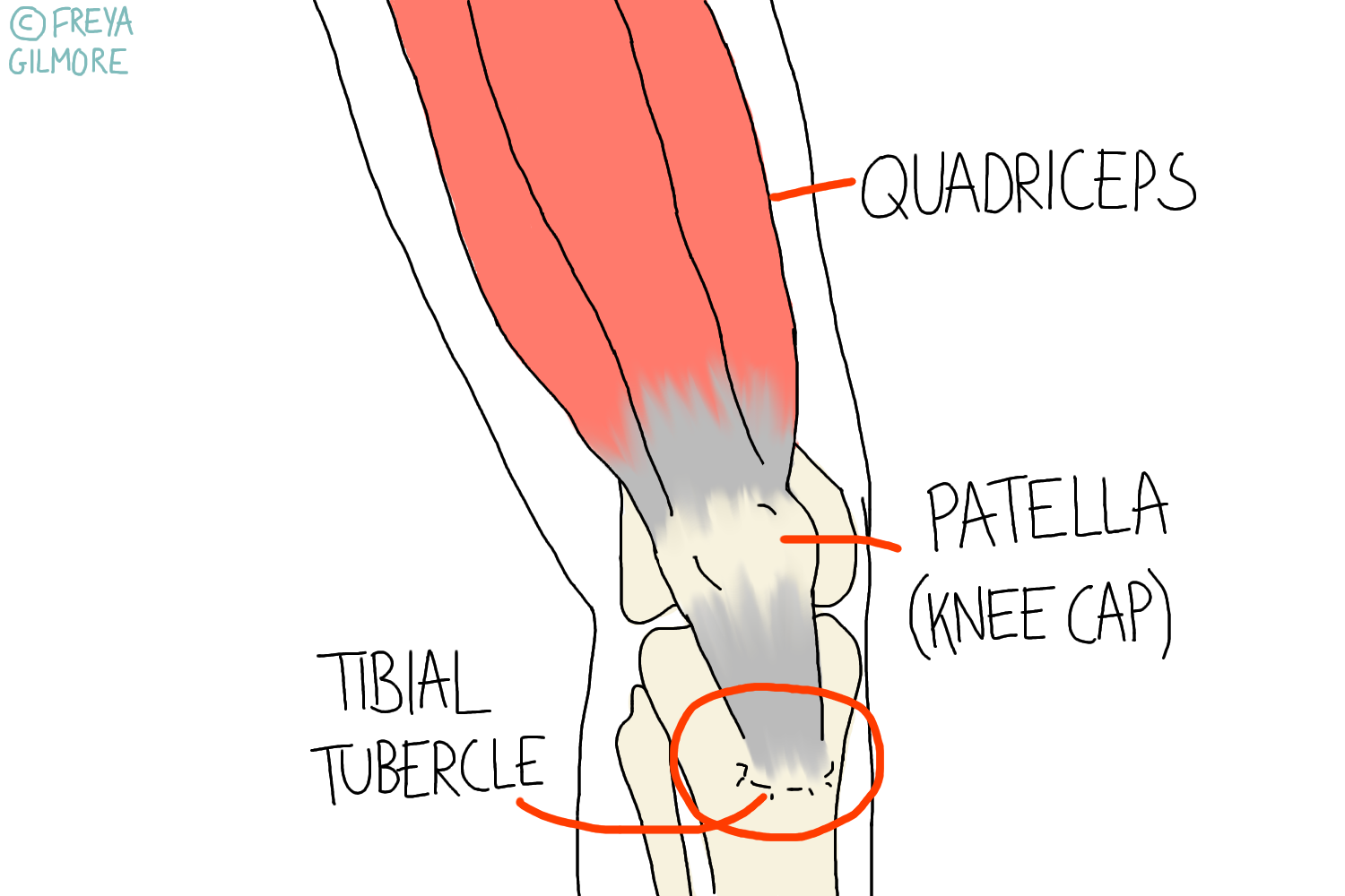 Read more about the article Osgood-Schlatter Disease