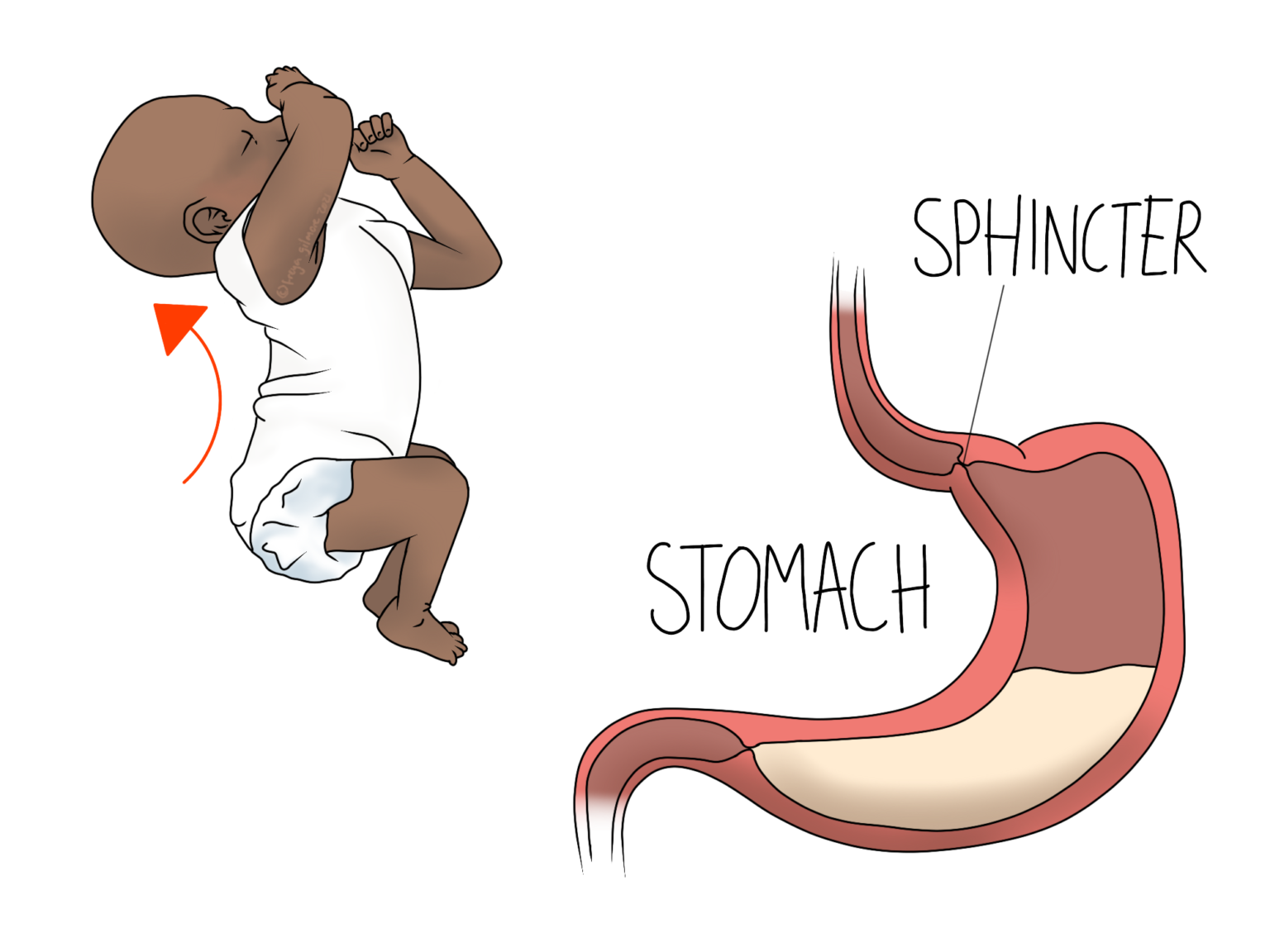 gastroesophageal-reflux-disease-gerd-bims-hospital